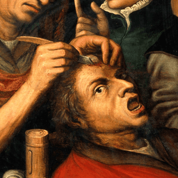 An operation for stone in the head. Miniature of an oil painting by a follow Wellcome depicting a man recieving an operation on his head